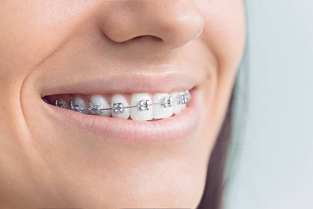 Best Invisalign and Clear Aligners  in Gwinn, MI